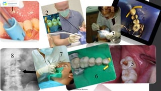 PAIN CONTROL IN OPERATIVE DENTISTRY AND ENDODONTICS.pptx