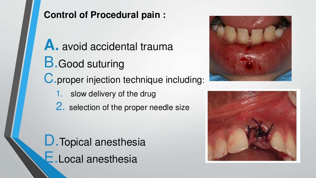 Pain control in oral surgery
