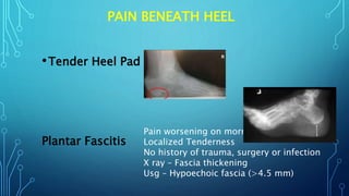 PAIN BENEATH HEEL
•Tender Heel Pad
Plantar Fascitis
Pain worsening on morning
Localized Tenderness
No history of trauma, surgery or infection
X ray – Fascia thickening
Usg – Hypoechoic fascia (>4.5 mm)
 