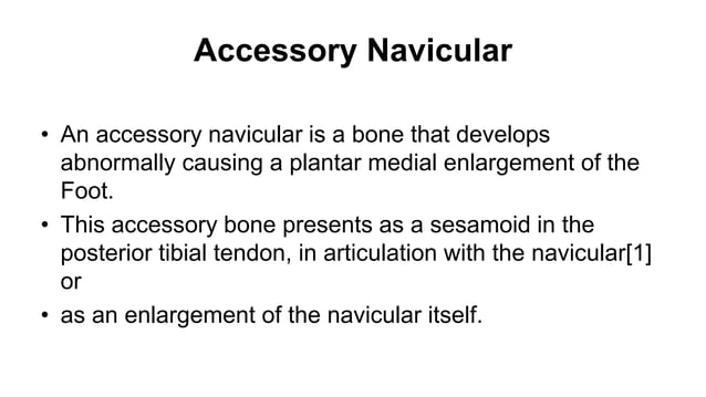 Right Accessory Navicular painfull accessory navicular bone(1).pptx | Death, Injury, or Military ...