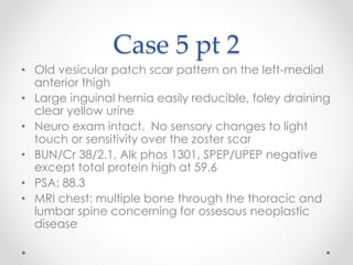 Case 5 pt 2 
• Old vesicular patch scar pattern on the left-medial 
anterior thigh 
• Large inguinal hernia easily reducible, foley draining 
clear yellow urine 
• Neuro exam intact. No sensory changes to light 
touch or sensitivity over the zoster scar 
• BUN/Cr 38/2.1, Alk phos 1301, SPEP/UPEP negative 
except total protein high at 59.6 
• PSA: 88.3 
• MRI chest: multiple bone through the thoracic and 
lumbar spine concerning for ossesous neoplastic 
disease 
 