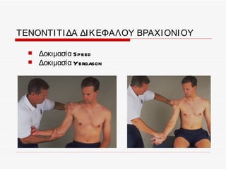 ΤΕΝΟΝΤΙ ΤΙ ΔΑ ΔΙ Κ ΕΦΑΛΟΥ ΒΡΑΧΙ ΟΝΙ ΟΥ

     Δοκιμασία Speed
     Δοκιμασία Yergason
 