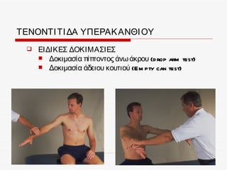 ΤΕΝΟΝΤΙ ΤΙ ΔΑ ΥΠΕΡΑΚ ΑΝΘΙ ΟΥ
     ΕΙΔΙΚΕΣ ΔΟΚΙΜΑΣΙΕΣ
       Δοκιμασία πίπτοντος άνω άκρου (d rop arm test)
       Δοκιμασία άδειου κουτιού (Em pty can test)
 