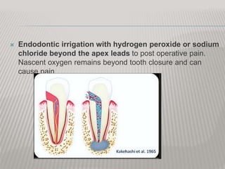  Endodontic irrigation with hydrogen peroxide or sodium
chloride beyond the apex leads to post operative pain.
Nascent oxygen remains beyond tooth closure and can
cause pain
 