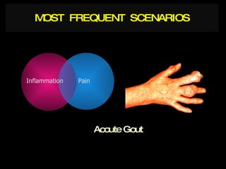 Accute Gout MOST  FREQUENT  SCENARIOS Pain Inflammation 