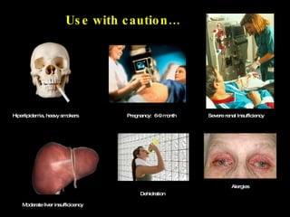 Use with caution… Pregnancy:  6-9 month Alergies Severe renal Insufficiency Moderate liver insufficicency Hiperlipidemia, heavy smokers Dehidration 