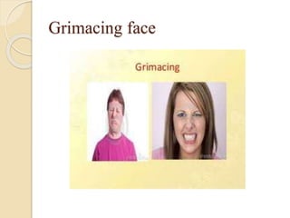 Grimacing face
 