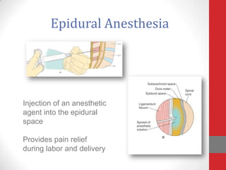 Epidural Anesthesia
Injection of an anesthetic
agent into the epidural
space
Provides pain relief
during labor and delivery
 