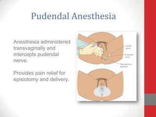 Pudendal Anesthesia
Anesthesia administered
transvaginally and
intercepts pudendal
nerve.
Provides pain relief for
episiotomy and delivery.
 
