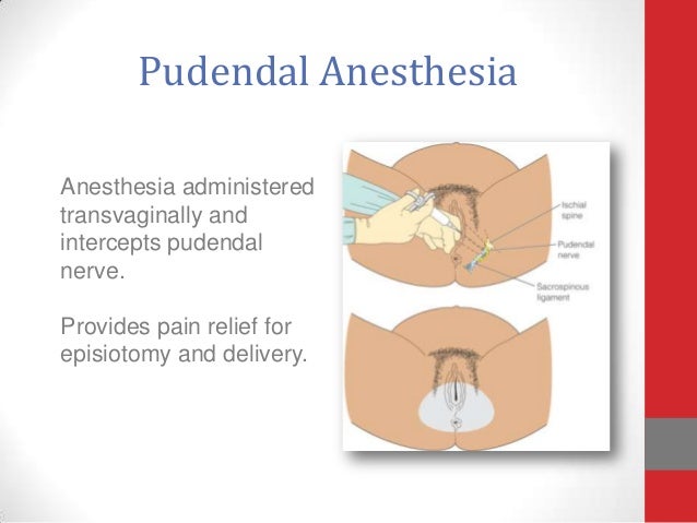childbirth anesthesis childbirth anesthesis