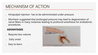 Pain management in Restorative dentistry and Endodontics - fathima ...