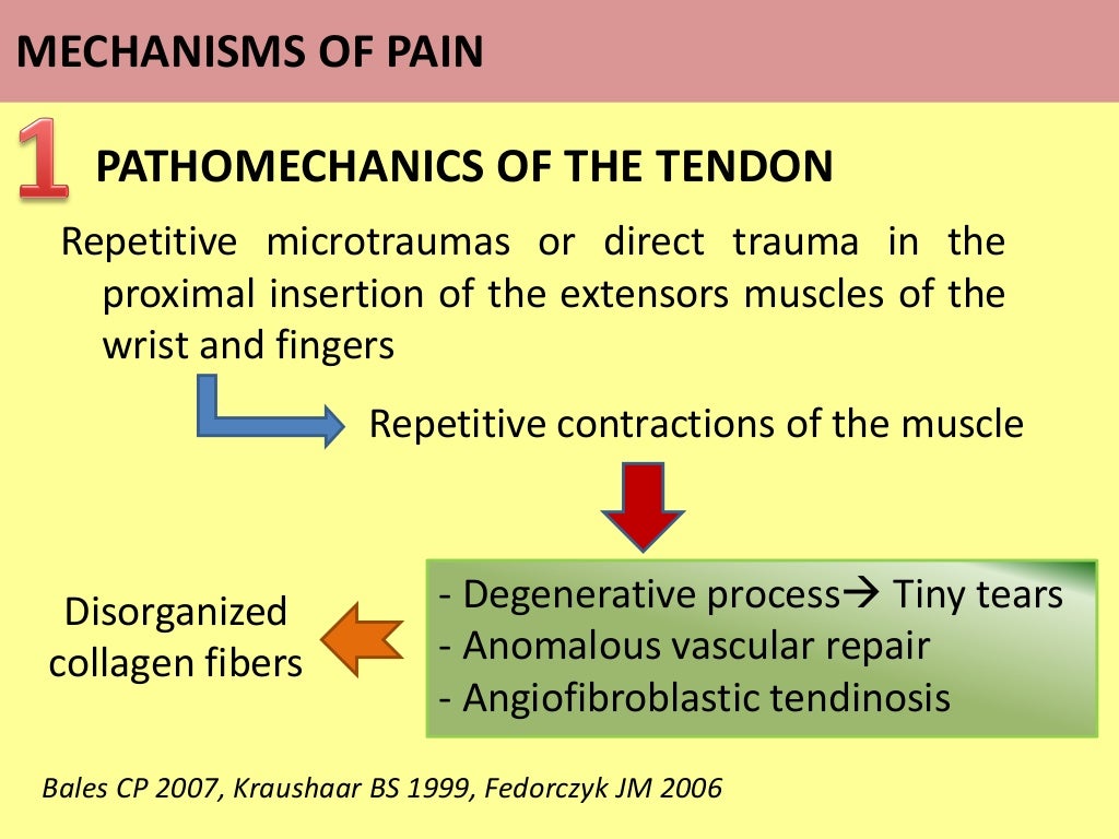 Lateral Epicondylalgia. What do we know about the pain mechanisms?
