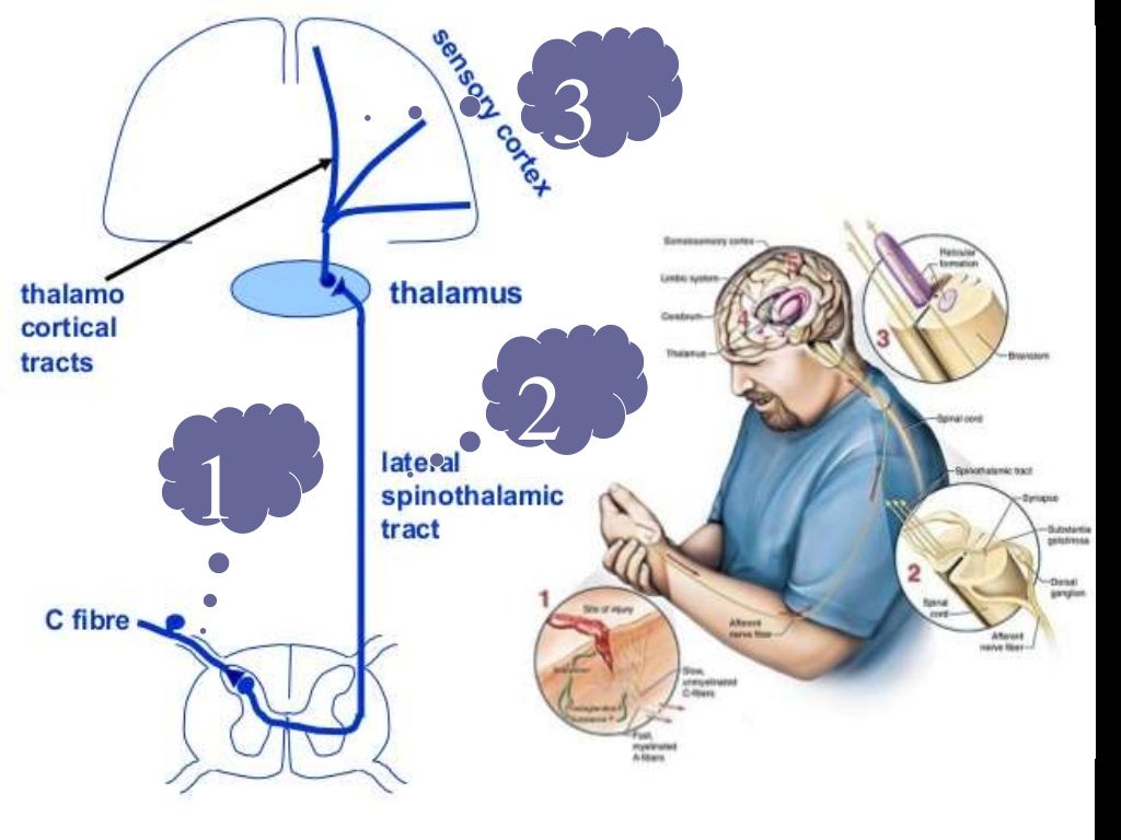 pain-management-ppt
