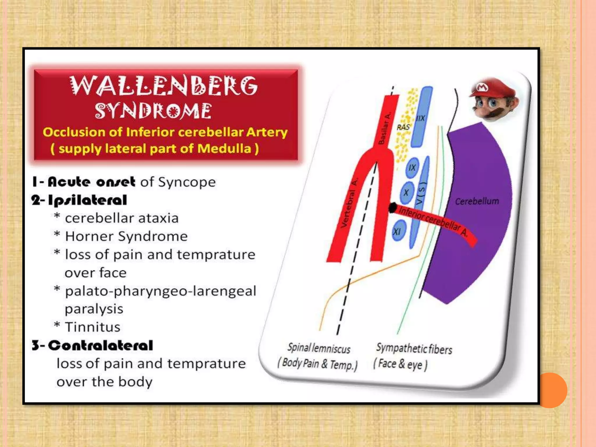 Pain pathway | PPTX