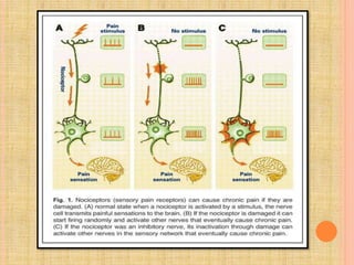 Pain pathway