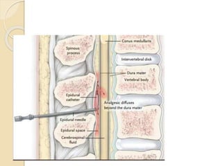 PATHOPHYSIOLOGY AND MANAGEMEMENT OF PAIN | PPTX