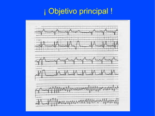 ¡ Objetivo principal !
 