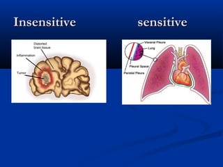 Insensitive sensitiveInsensitive sensitive
 