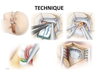 TECHNIQUE
276/16/2020
 