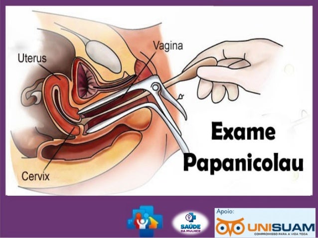 Exame papanicolau preparo