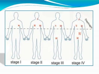Mp@hl Staging Paithankar Adwait 7610 m2a Hodgkins Lymphoma hemat.pptx