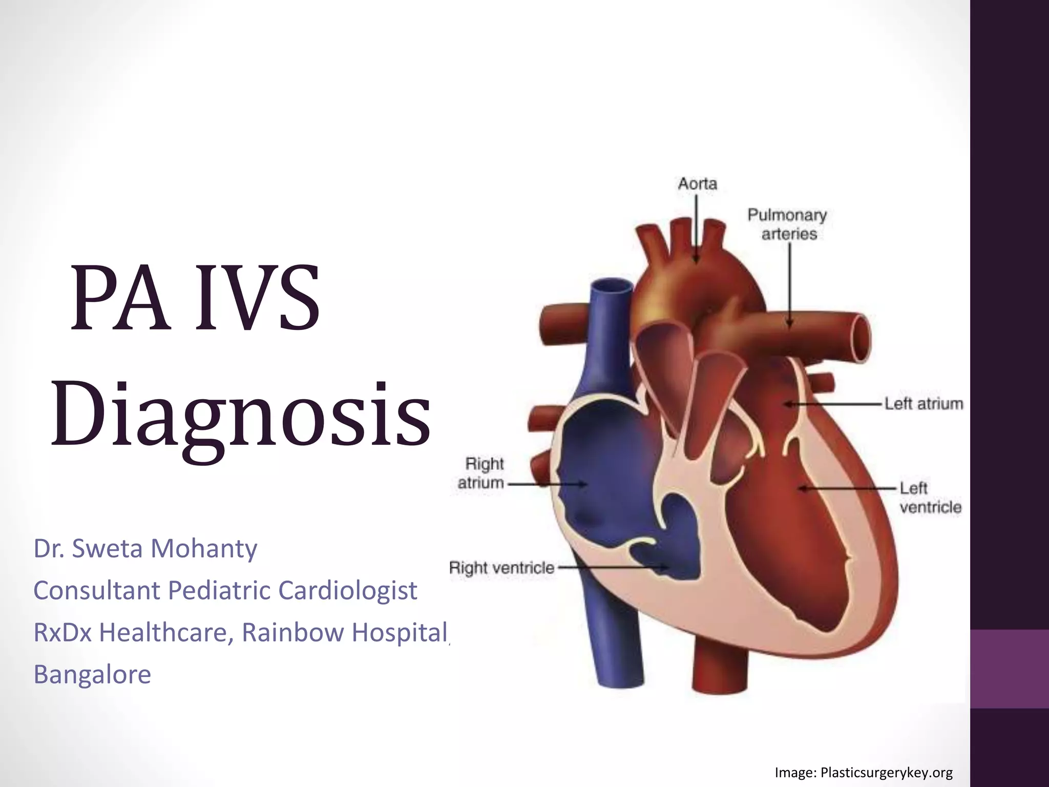 Pulmonary atresia with intact interventricular septum | PPTX