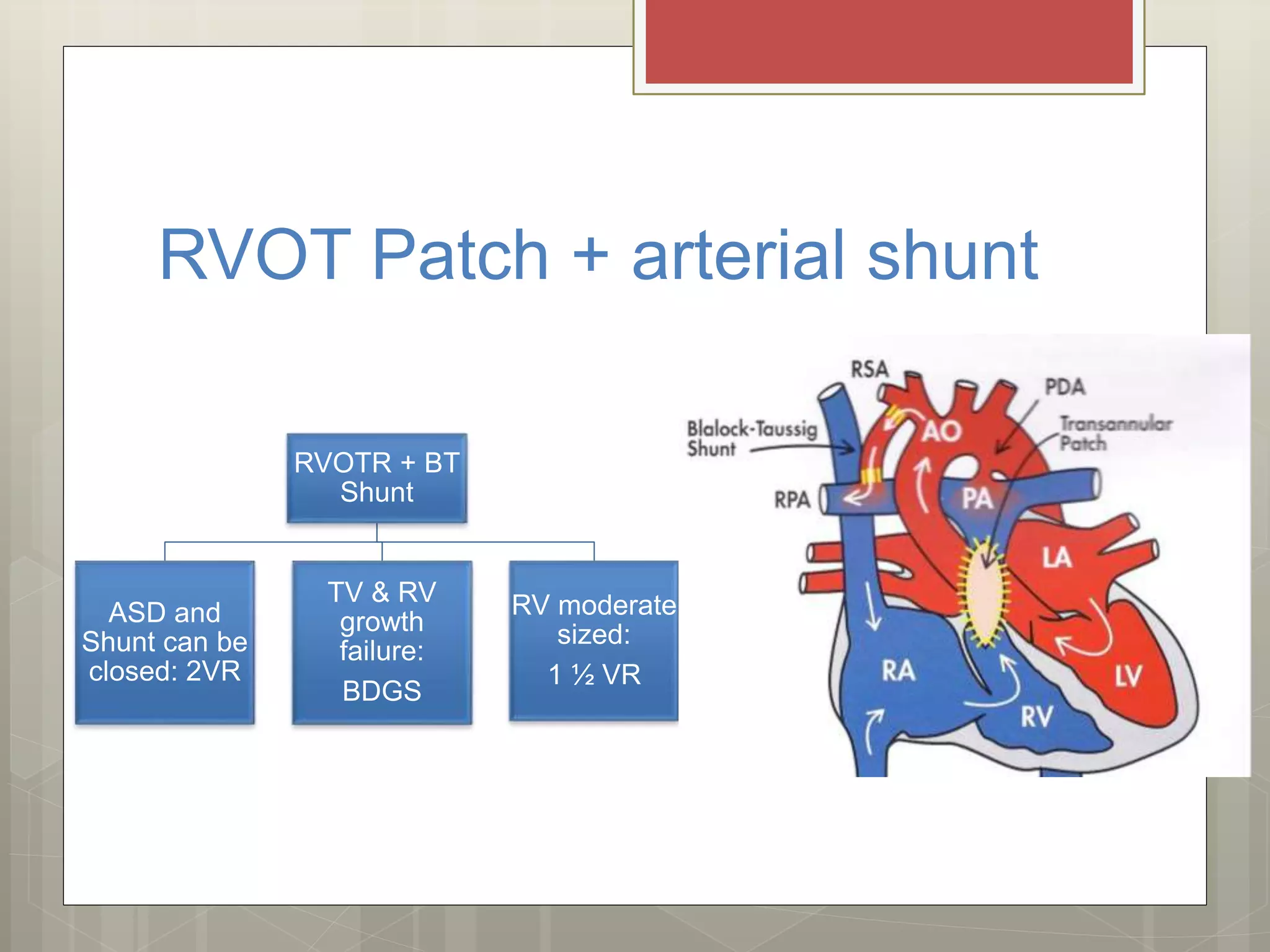 Pulmonary atresia with intact interventricular septum management | PPTX