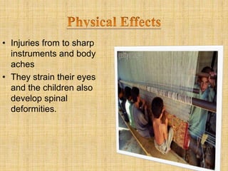 • Injuries from to sharp
instruments and body
aches
• They strain their eyes
and the children also
develop spinal
deformities.
 