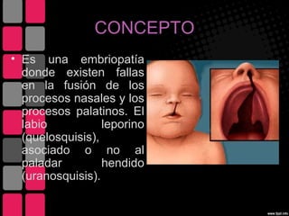 CONCEPTO
• Es una embriopatía
  donde existen fallas
  en la fusión de los
  procesos nasales y los
  procesos palatinos. El
  labio           leporino
  (quelosquisis),
  asociado o no al
  paladar         hendido
  (uranosquisis).
 