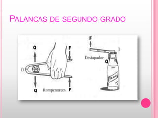 Palancas de segundo grado