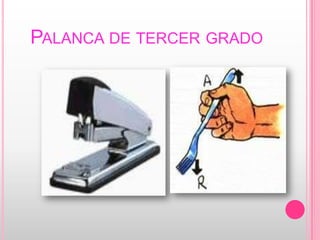Palanca de tercer grado