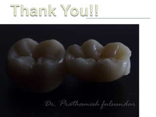 Removable Palatal Augmentation Prosthesis