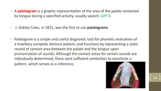 • A palatogram is a graphic representation of the area of the palate contacted
by tongue during a specified activity, usually speech- GPT 8.
• J. Oakley Coles, in 1871, was the first to use palatograms
• Palatogram is a simple and useful diagnostic tool for phonetic evaluation of
a maxillary complete denture patient, and functions by representing a static
record of contact area between the palate and the tongue upon
pronunciation of sounds. Although the contact areas for certain sounds are
individually determined, there exist sufficient similarities to constitute a
pattern, which serves as a reference.
14
 