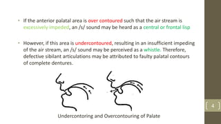 • If the anterior palatal area is over contoured such that the air stream is
excessively impeded, an /s/ sound may be heard as a central or frontal lisp
• However, if this area is undercontoured, resulting in an insufficient impeding
of the air stream, an /s/ sound may be perceived as a whistle. Therefore,
defective sibilant articulations may be attributed to faulty palatal contours
of complete dentures.
4
Undercontoring and Overcontouring of Palate
 