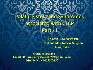 Palatal Fistula and Syndromes 
associated with CLCP 
Part - I 
Dr. Amit T. Suryawanshi 
Oral and Maxillofacial Surgeon 
Pune, India 
Contact details : 
Email ID - amitsuryawanshi999@gmail.com 
Mobile No - 9405622455 
 
