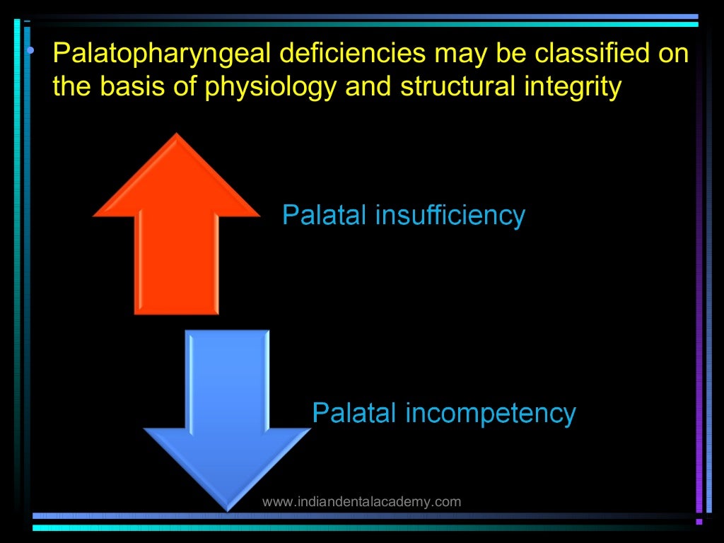 Palatal lift prosthesis/ orthodontic straight wire technique