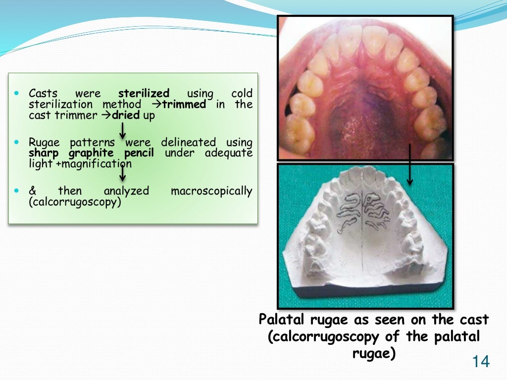 Palatal rugae as an aid for personnel identification