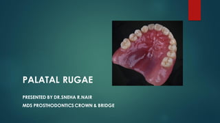 PALATAL RUGAE
PRESENTED BY DR.SNEHA R.NAIR
MDS PROSTHODONTICS CROWN & BRIDGE
 