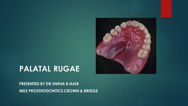 PALATAL RUGAE IN FORENSIC ODONTOLOGY | PDF | Oral care | Personal Care