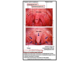 palate.pptx