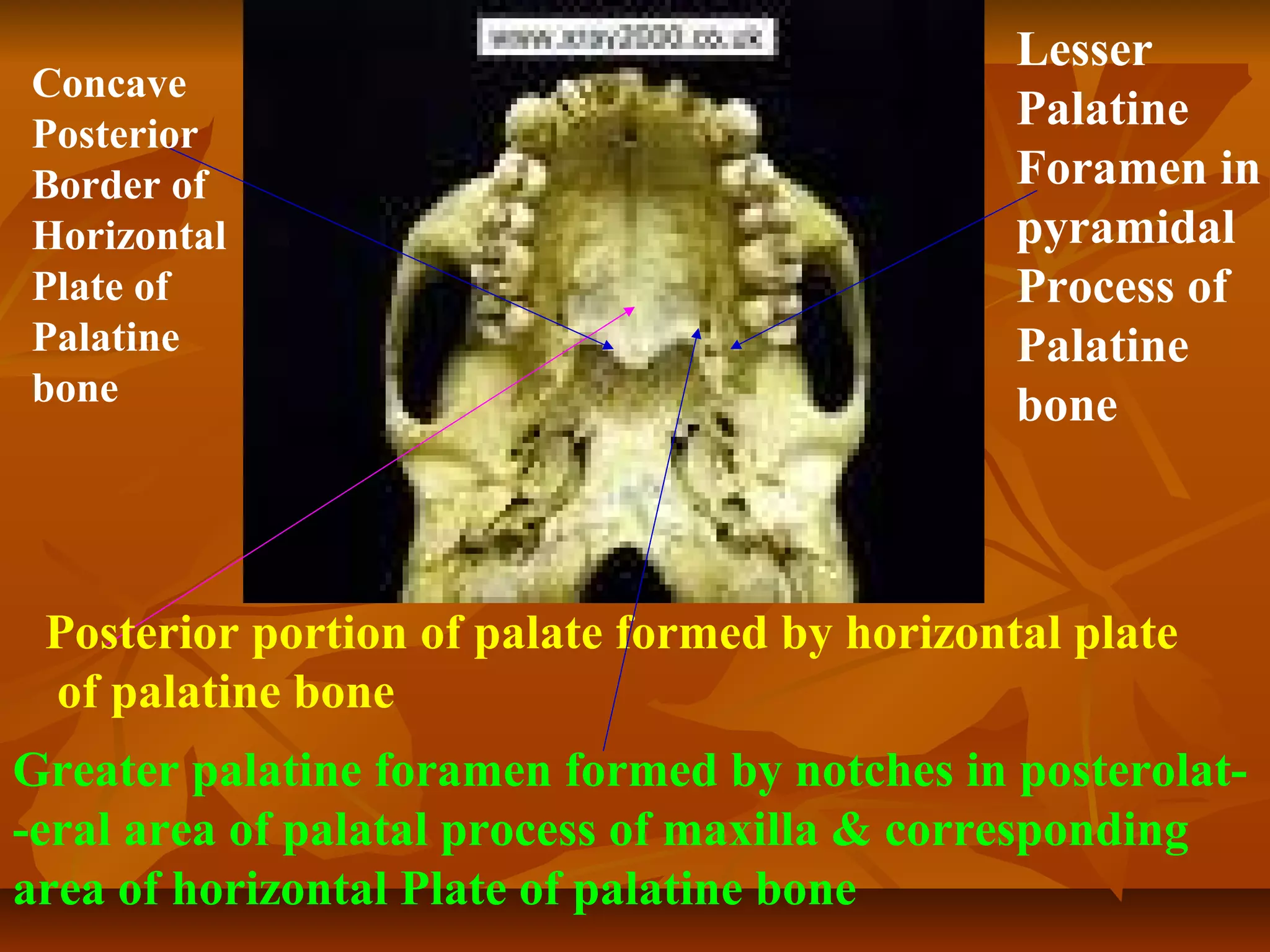 Posterior portion of palate formed by horizontal plate
of palatine bone
Greater palatine foramen formed by notches in posterolat-
-eral area of palatal process of maxilla & corresponding
area of horizontal Plate of palatine bone
Lesser
Palatine
Foramen in
pyramidal
Process of
Palatine
bone
Concave
Posterior
Border of
Horizontal
Plate of
Palatine
bone
 