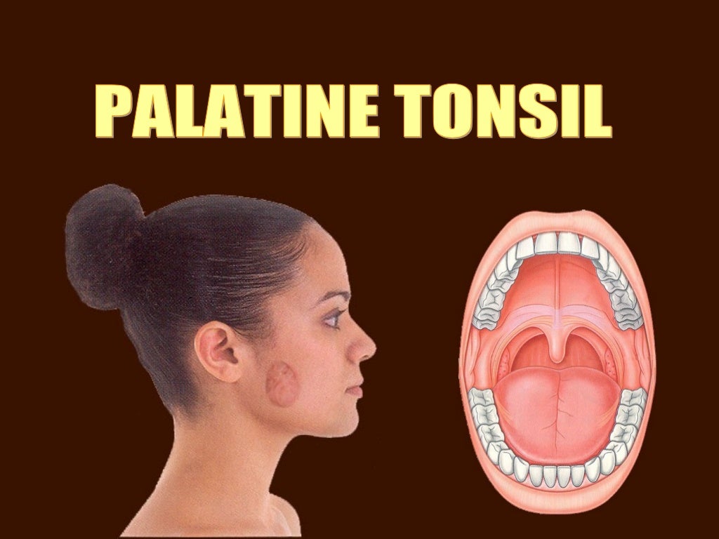Palatine tonsil