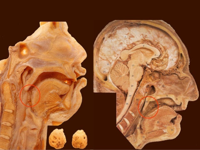 palatine tonsils