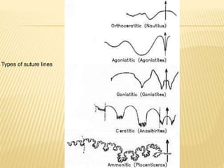 Types of suture lines
 
