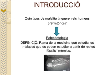 INTRODUCCIÓ
  Quin tipus de malaltia tingueren els homens
                 prehistòrics?



                Paleopatologia
DEFINICIÓ: Rama de la medicina que estudia les
 malaties que es poden estudiar a partir de restes
                 fòssils i mòmies.
 