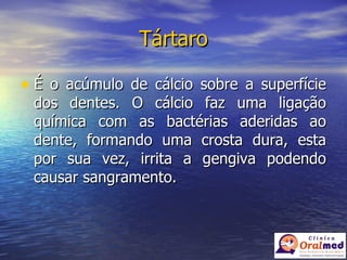 Tártaro É o acúmulo de cálcio sobre a superfície dos dentes. O cálcio faz uma ligação química com as bactérias aderidas ao dente, formando uma crosta dura, esta por sua vez, irrita a gengiva podendo causar sangramento. 