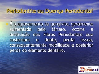Periodontite ou Doença Periodontal É o agravamento da gengivite, geralmente aumentada pelo tártaro, ocorre a destruição das Fibras Periodontais que sustentam o dente, perda óssea, consequentemente mobilidade e posterior perda do elemento dentário. 