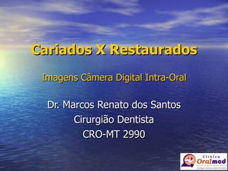 Cariados X Restaurados Dr. Marcos Renato dos Santos Cirurgião Dentista CRO-MT 2990 Imagens Câmera Digital Intra-Oral 