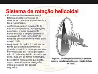 Sistema de rotação helicoidal
• O sistema utilizado é o de rotação
total da ampola, sendo que os
detectores podem ser móveis ou fixos
(3a e 4a geração).
• A diferença está no movimento da
mesa com o paciente. Nas gerações
anteriores, a mesa do paciente
movia-se após a ampola terminar a
aquisição do corte (após 360º de
rotação), posicionando-se então para
o novo corte.
• A aquisição de dados é contínua, de
forma que a ampola permanece
girando enquanto a mesa permanece
movimentando-se. Neste processo,
não há mais a aquisição de dados por
corte, mas sim de forma ininterrupta.
• É o sistema mais rápido que existe,
capaz de realizar uma tomografia
inteira de coluna em poucos
segundos.
 
