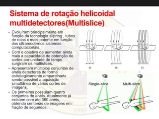 Sistema de rotação helicoidal
multidetectores(Multislice)
• Evoluíram principalmente em
função da tecnologia slipring , tubos
de raios x mais potente em função
dos ultramodernos sistemas
computacionais.
• Com o objetivo de aumentar ainda
mais a capacidade de obtenção de
cortes por unidade de tempo
surgiram os multislices.
• Apresentam múltiplos conjuntos de
anéis detectores de forma
estrategicamente emparelhada
sendo possível a aquisição
simultânea de vários cortes de
imagens.
• Os primeiros possuíam quatro
conjuntos de anéis. Atualmente já
existem com ate 360 anéis,
obtendo centenas de imagens em
fração de segundos.
 